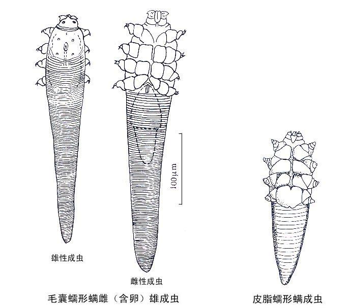蠕形螨