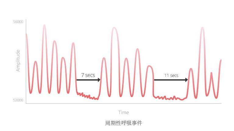 呼吸率