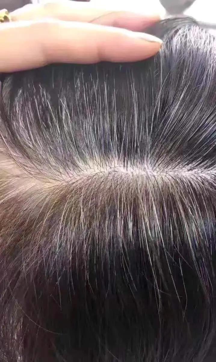 白发转黑